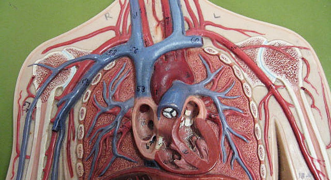 hypertension