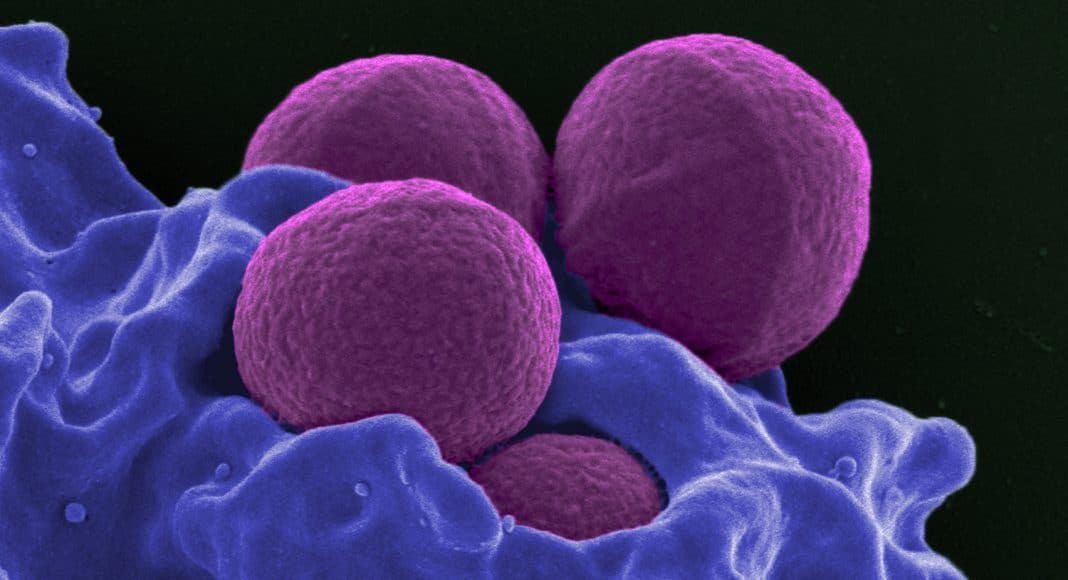 superbugs