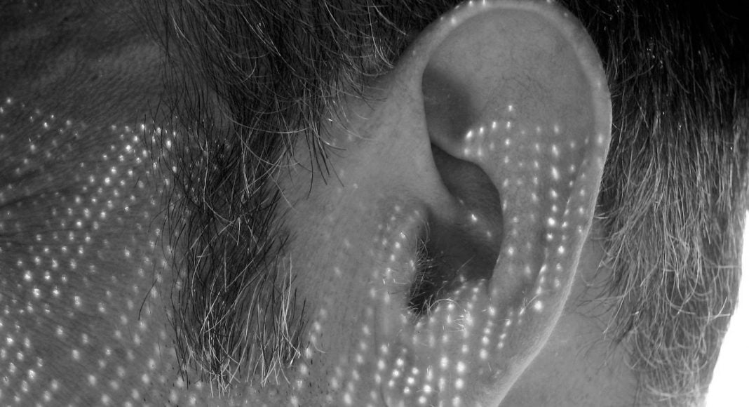 Tinnitus