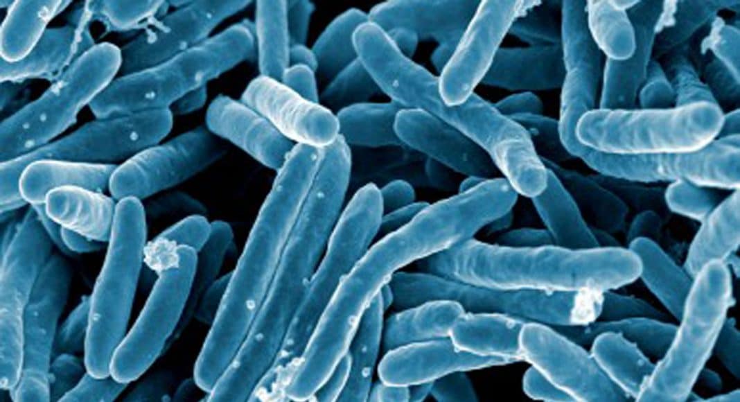 tuberculosis