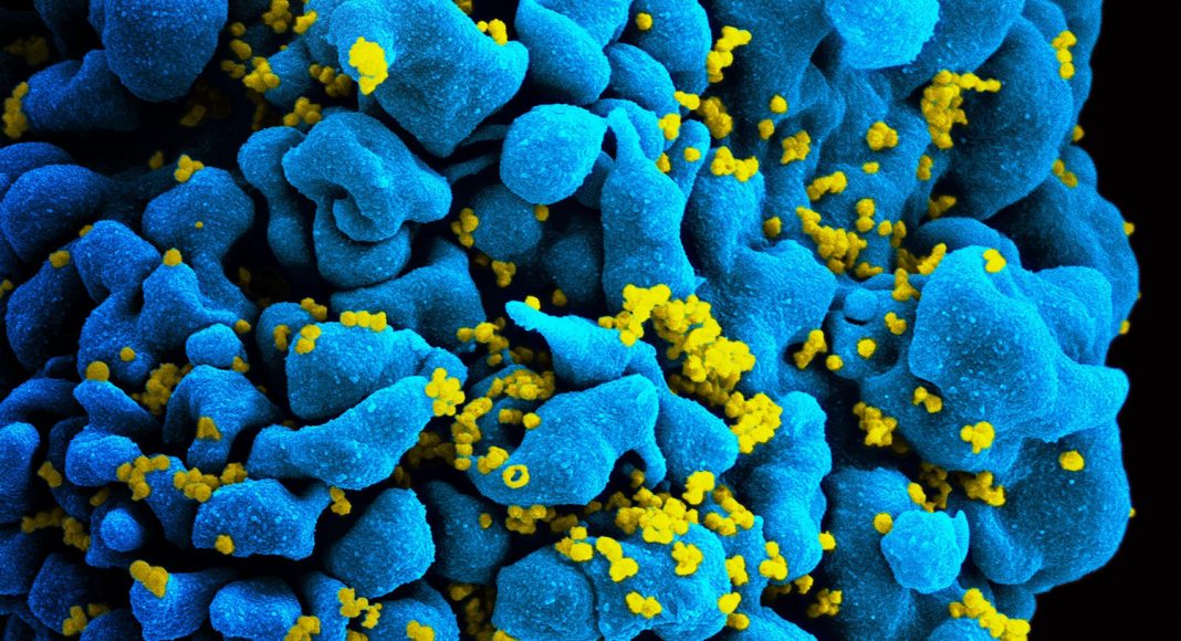 Science: A Few Doses Of Marijuana Can Tackle HIV Symptoms