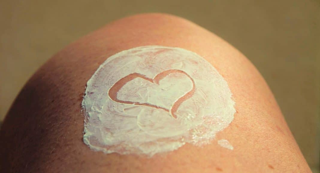 Psoriasis