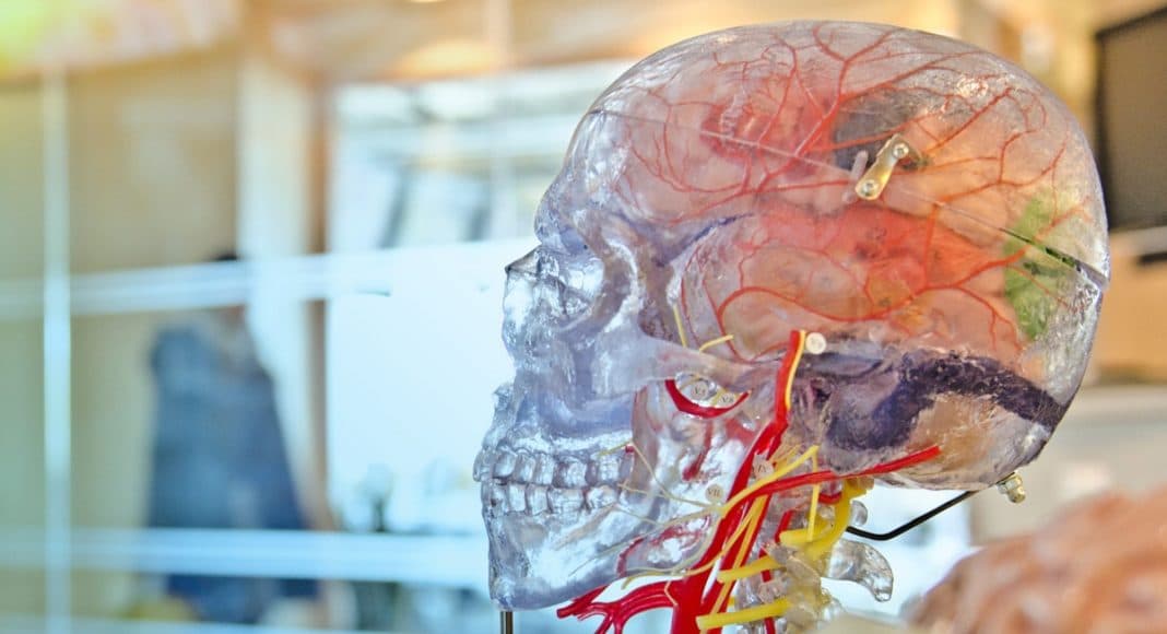 brain cancer