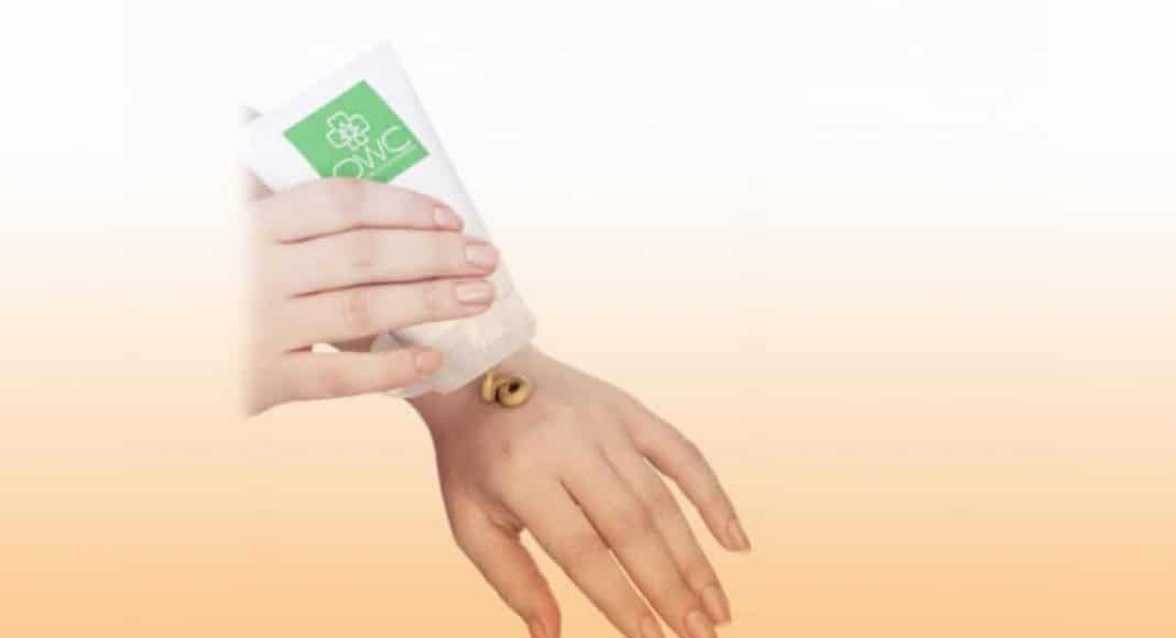 Suffer From Psoriasis? This Marijuana Cannabis Cream Is Here To Help