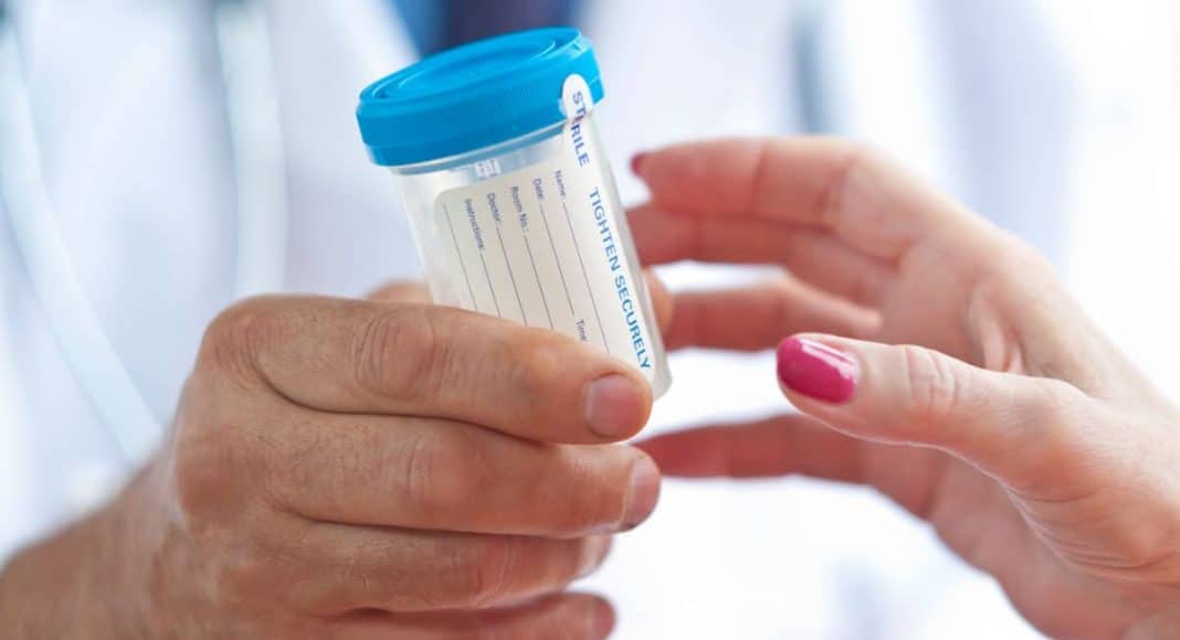 drug tests