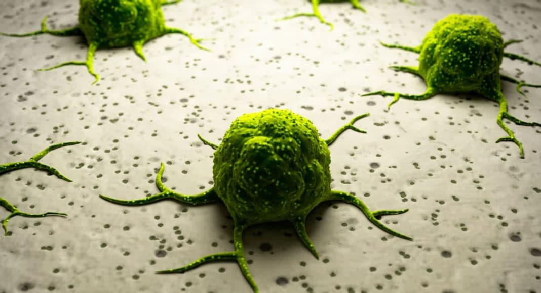 Marijuana Cure Cancer