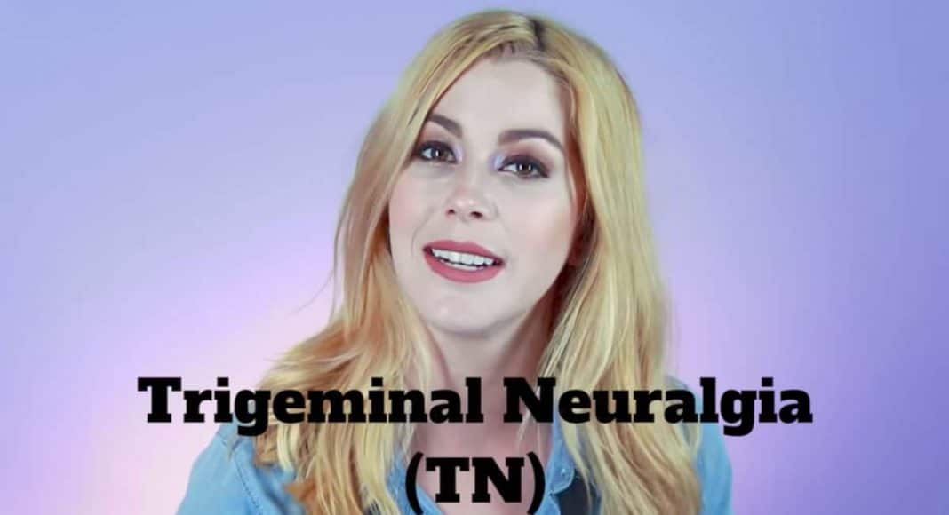Trigeminal Neuralgia