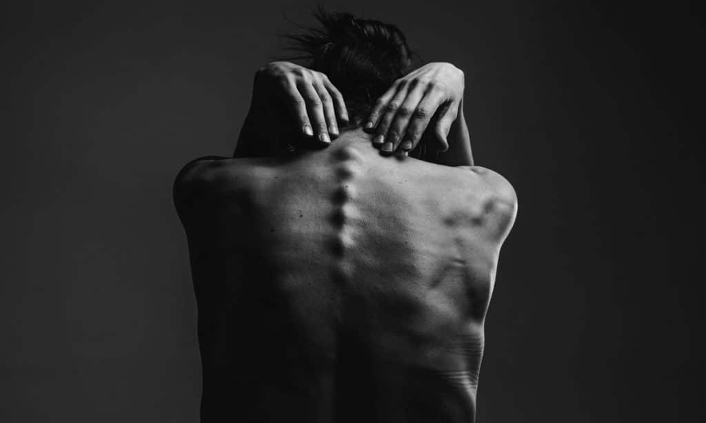 Spinal Cord Injuries