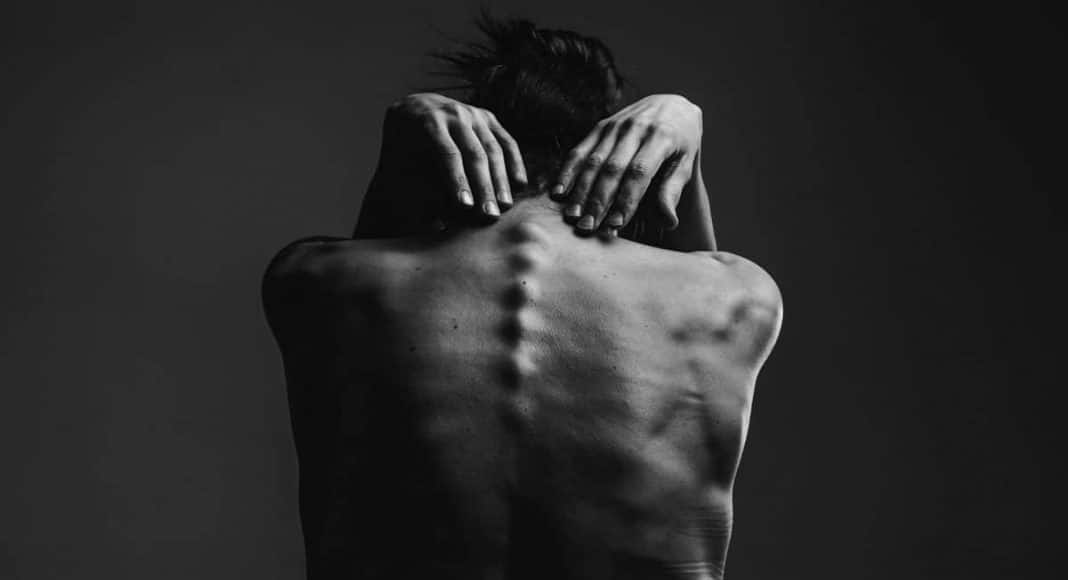 Spinal Cord Injuries