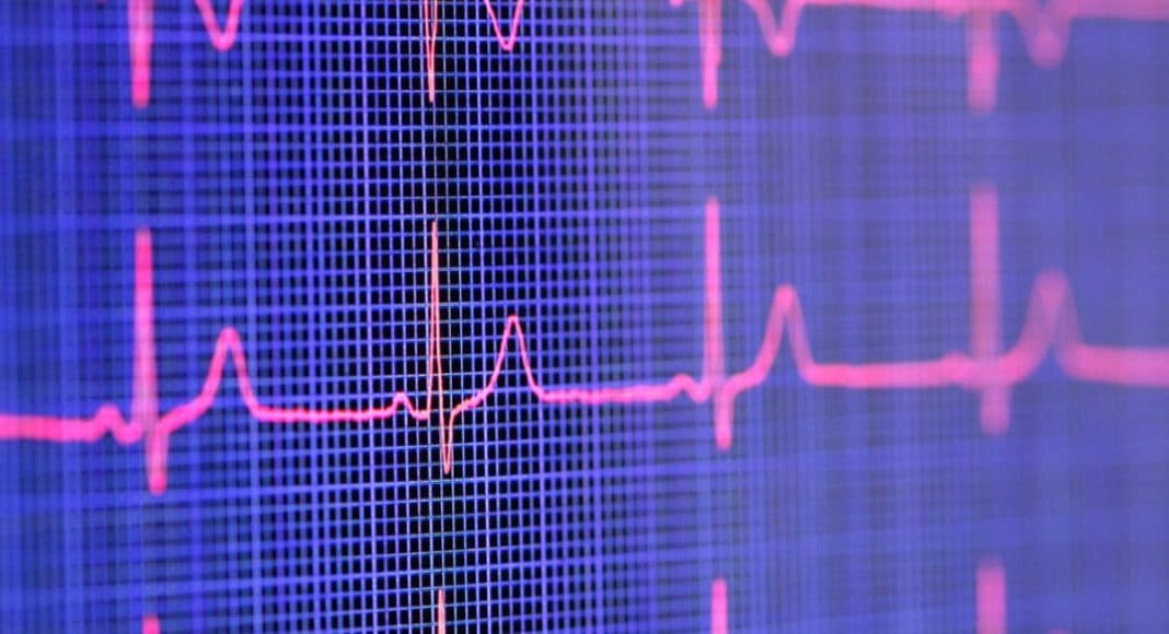 Is Marijuana Worse Than Tobacco For Cardiovascular Health