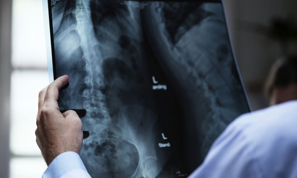 Having Orthopedic Surgery? Cannabis Will Help