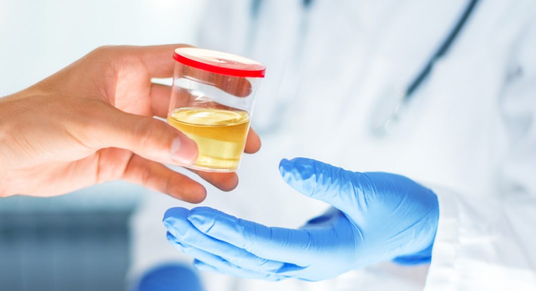 Crazy Stuff People Do To Pass A Drug Test