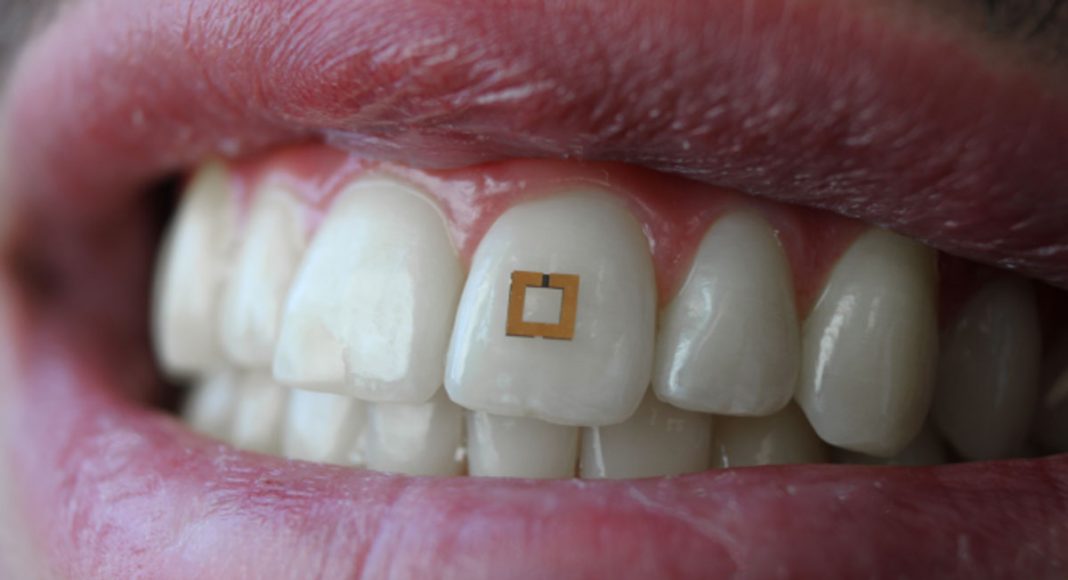 This 'Smart Tooth' Can Track Everything You Eat