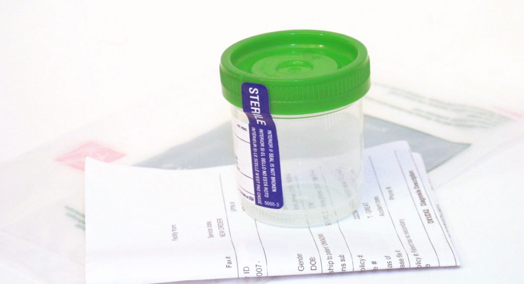 Businesses Are Dropping Mandatory Marijuana Drug Testing