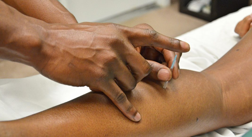 What Can You Expect At Your First Acupuncture Appointment