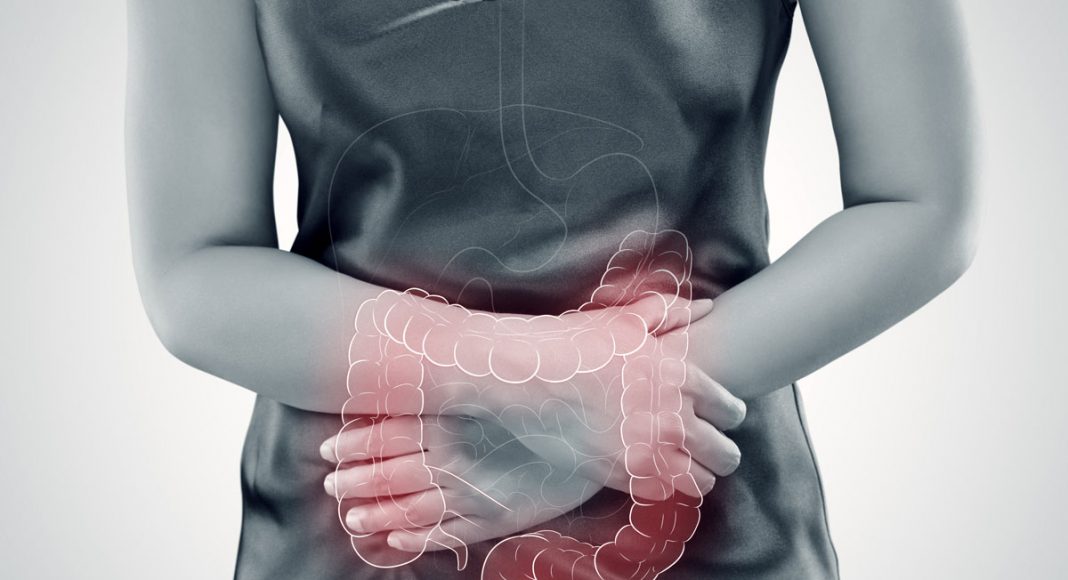 Yes, Cannabis Fights Chronic Gut Problems — Here's How