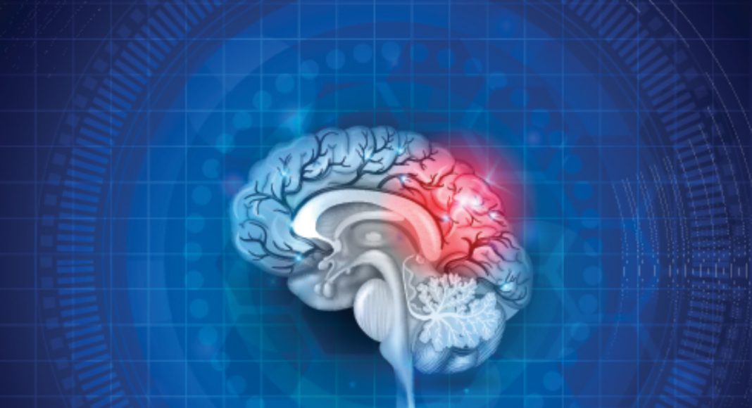 cannabis optimal treatment method for post concussion syndrome symptoms