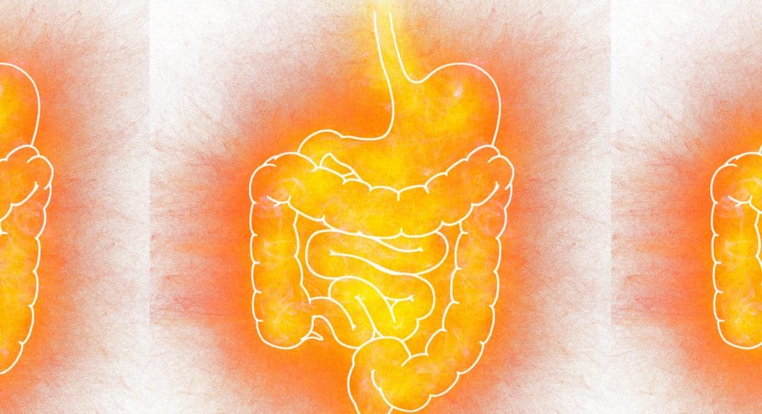 Does Cannabis Boost Your Gut Bacteria