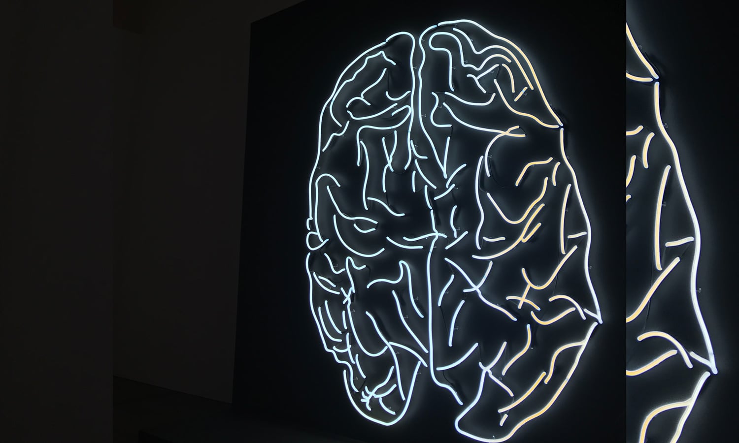 Science Confirms CBD Could Helps Neurodegenerative Diseases