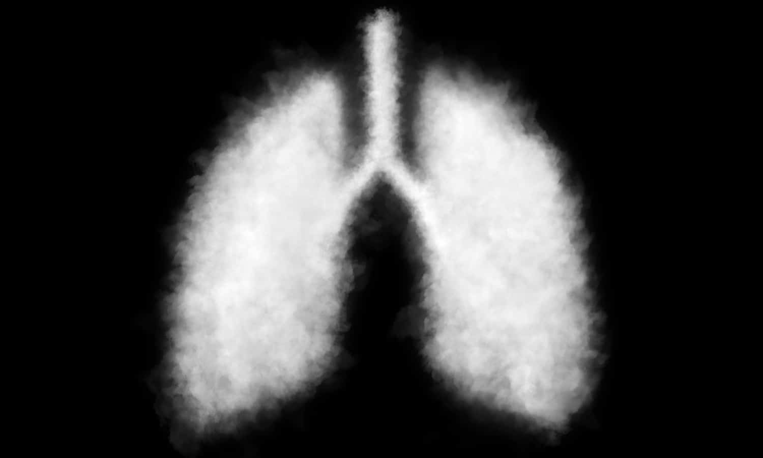 Legal Marijuana States Suffered Less Vaping-Related Lung Illnesses