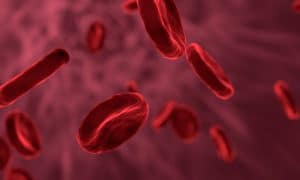 Marijuana Shows Promise in Sickle Cell Disease Treatment