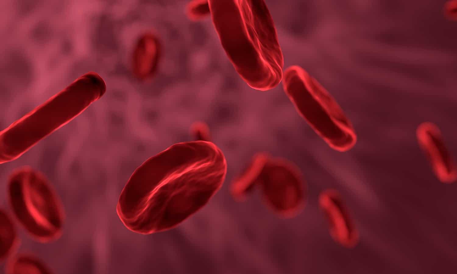 Marijuana Shows Promise in Sickle Cell Disease Treatment