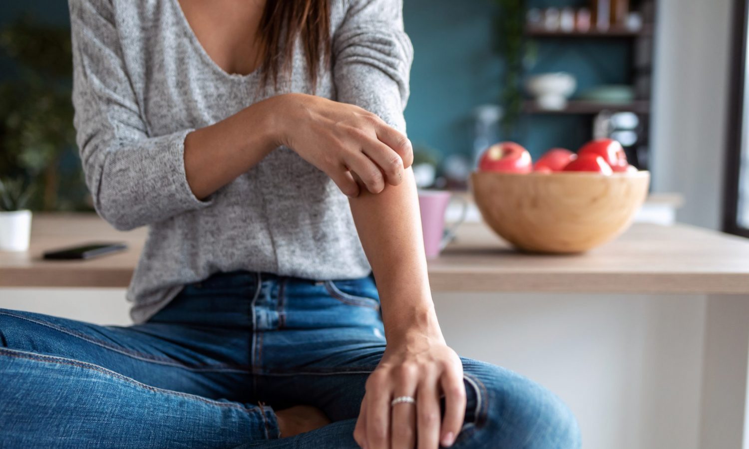 psoriasis