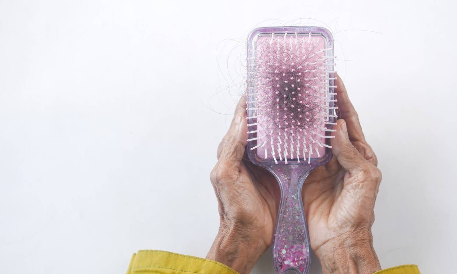 hair loss
