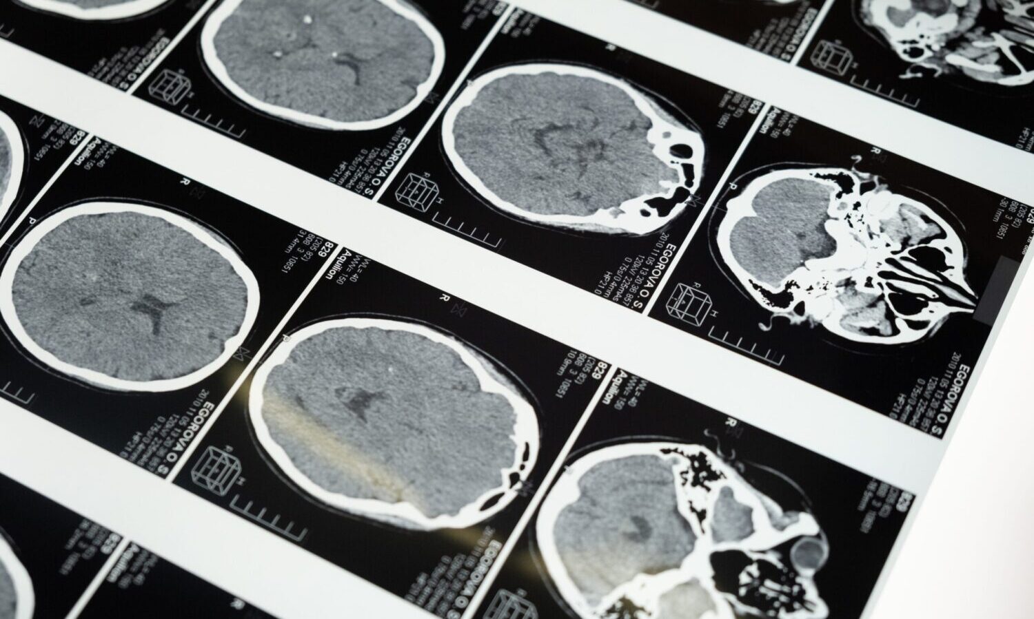 brain