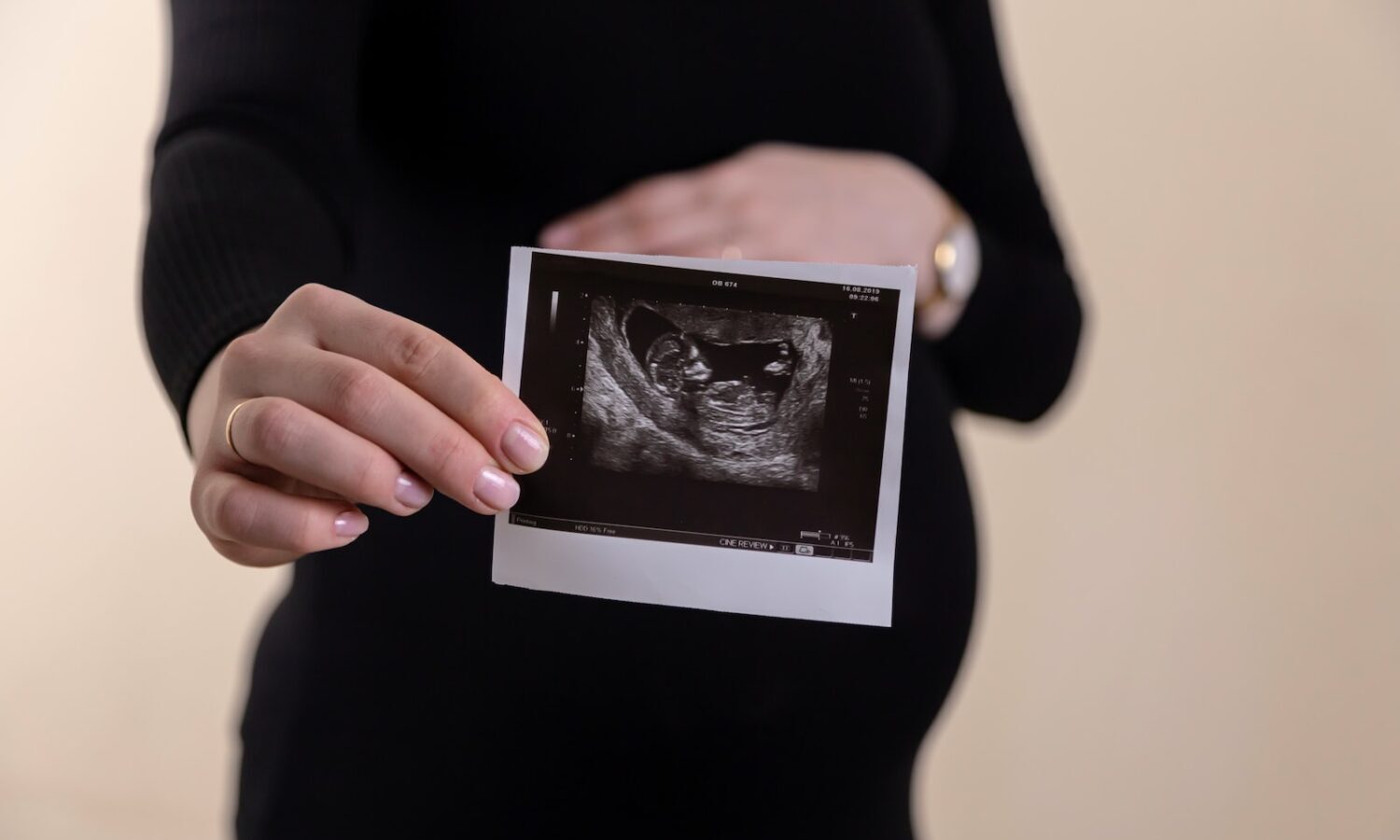 fertility pregnant